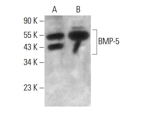 BMP-5 Antibody (MM0117-9G27) | SCBT - Santa Cruz Biotechnology