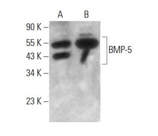 western blotting image from recommended BMP-5 (MM0117-9G27) monoclonal antibody replacement. Image 376896