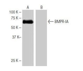 BMPR-IA Antibody (7K7) - Western Blotting - Image 64874 