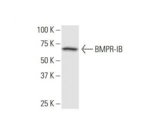 BMPR-IB Antibody (2E2) - Western Blotting - Image 352098 
