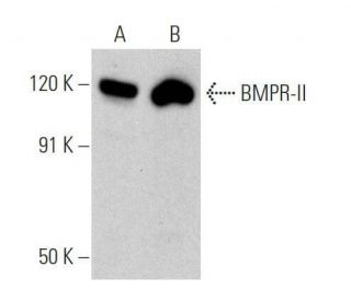western blotting image from recommended BMPR-II (E-1) monoclonal antibody replacement. Image 356296