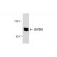 BMPR-II Antibody (Z-18) - Western Blotting - Image 128461