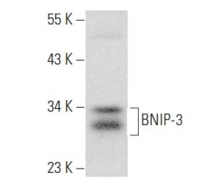 BNIP-3 Antibody (ANa40) - Western Blotting - Image 354932The Double Nickase Plasmid features a U6 promoter for sgRNA expression, a 20 nt targeting sequence, and a gRNA scaffold to guide Cas9n. It includes a CBh promoter for Cas9n (D10A) and puromycin resistance, GFP for transfection verification, and nuclear localization signals (NLS). The 2A peptide allows co-expression of Cas9n and Puro from a single promoter, enabling precise genome editing with reduced off-target effects. 