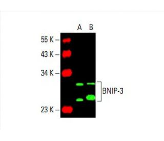 BNIP-3 Antibody (ANa40) - Western Blotting - Image 394854The Double Nickase Plasmid features a U6 promoter for sgRNA expression, a 20 nt targeting sequence, and a gRNA scaffold to guide Cas9n. It includes a CBh promoter for Cas9n (D10A) and puromycin resistance, GFP for transfection verification, and nuclear localization signals (NLS). The 2A peptide allows co-expression of Cas9n and Puro from a single promoter, enabling precise genome editing with reduced off-target effects.
