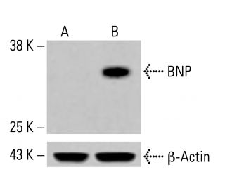 BNP Antibody (D-8) - Western Blotting - Image 413905 