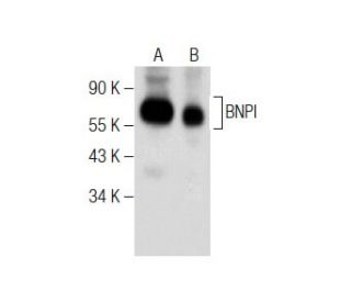 BNPI Antibody (A-8) - Western Blotting - Image 284425 