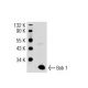 Bob 1 Antibody (Wue-AC5) - Western Blotting - Image 32849 