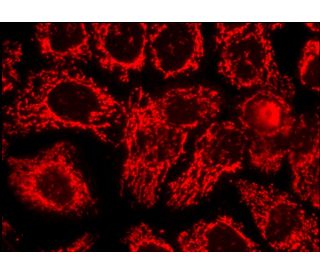 LRP130 (H-300): sc-66844. Immunofluorescence staining of formalin-fixed A-431 cells showing mitochondrial localization. De