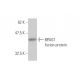 BPAG1 Antibody (1B10) - Western Blotting - Image 348443
