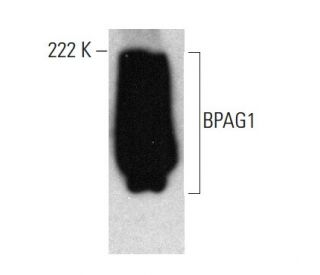 BPAG1 Antibody (1B10) - Western Blotting - Image 384467 