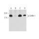 bpV(pic): sc-221379. Western blot analysis of Cofilin 1 phosphorylation in K-562 (A), lambda phosphatase (sc-200312) treat