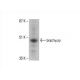brachyury Antibody (D-10) - Western Blotting - Image 394047