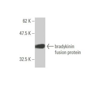 bradykinin Antibody (4A1) - Western Blotting - Image 348532