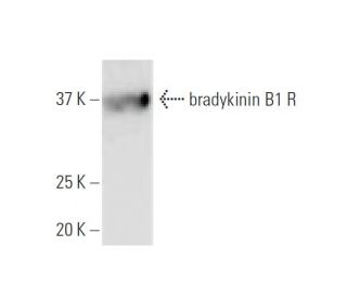 bradykinin B1 R Antibody (3A2) - Western Blotting - Image 347537 