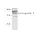 bradykinin B1 R Antibody (3A2) - Western Blotting - Image 347536