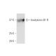 bradykinin B1 R Antibody (3A2) - Western Blotting - Image 347537 