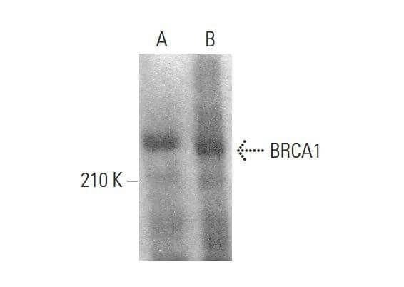 BRCA1 Antibody 287.17 SCBT Santa Cruz Biotechnology