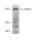 BRCA1 Antibody (287.17) - Western Blotting - Image 374966