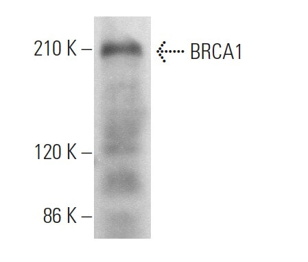 BRCA1 Antibody 287.17 SCBT Santa Cruz Biotechnology