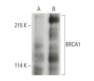 BRCA1 Antibody C 11 SCBT Santa Cruz Biotechnology