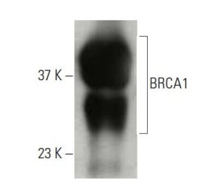 BRCA1 Antibody (C-11) - Western Blotting - Image 397517 