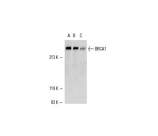 western blotting image from recommended BRCA1 (D-9) monoclonal antibody replacement. Image 357