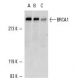 western blotting image from recommended BRCA1 (D-9) monoclonal antibody replacement. Image 357