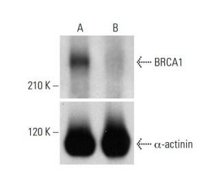 BRCA1 Antibody D 9 SCBT Santa Cruz Biotechnology