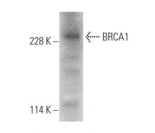 BRCA1 Antibody D 9 SCBT Santa Cruz Biotechnology