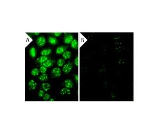 BRCA1 siRNA (h): sc-29219. Immunofluorescence staining of methanol-fixed, control HeLa (A) and BRCA1 siRNA silenced HeLa ( 