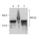 BRCA2 Antibody (D-8) - Western Blotting - Image 399169