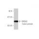 western blotting image from recommended BRCA2 (3D12) monoclonal antibody replacement. Image 348444