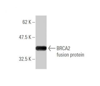 BRCA2 Antibody (3D12) - Western Blotting - Image 348444Each CRISPR/Cas9 Knockout (KO) Plasmid product consists of a pool of 3 plasmids designed to ensure identification and cleavage of a specific gene for maximum knockout efficiency. Each plasmid encodes a unique 20 nt sequence derived from the GeCKO (v2) library.