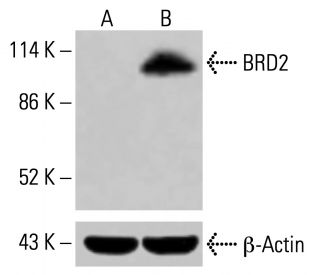 BRD2 Antibody (G-4) - Western Blotting - Image 415300