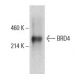 BRD4 Antibody (C-2) - Western Blotting - Image 399348 