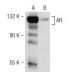 Brefeldin A (BFA): sc-200861. Western blot analysis of AR expression in untreated (A) and Brefeldin A (BFA) treated (B) LN