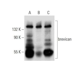 brevican Antibody (2) - Western Blotting - Image 138303 