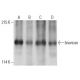brevican Antibody (2) - Western Blotting - Image 396114