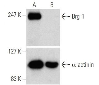 Brg-1 siRNA (h): sc-29827. Western blot analysis of Brg-1 expression in non-transfected control (A) and Brg-1 siRNA transf 