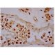 BRIP1 Antibody (E-11) - Immunohistochemistry - Image 350180 