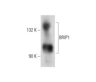 BRIP1 Antibody (E-11) - Western Blotting - Image 144554 