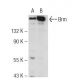 western blotting image from recommended Brm (E-6) monoclonal antibody replacement. Image 84130