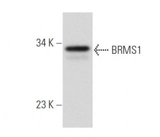 BRMS1 Antibody (4H7) - Western Blotting - Image 39547 