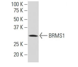 BRMS1 Antibody (4H7) - Western Blotting - Image 34578 
