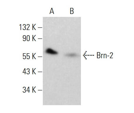 Anti-Brn-2 (POU3F2) Antibody, clone 8C4.2 clone 8C4.2, from mouse