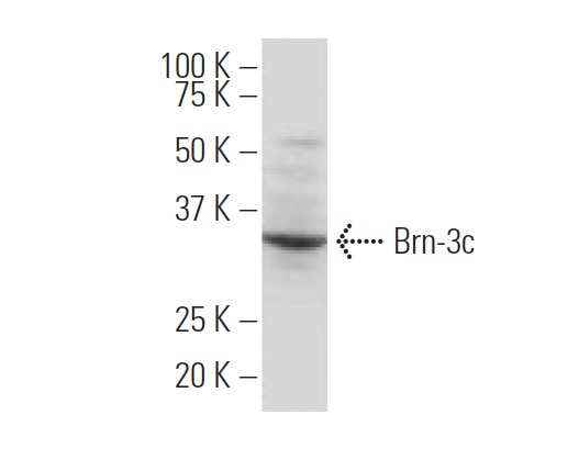 Brn-3c/BRN3C/POU4F3 Antibody (QQ8)