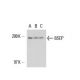 western blotting image from recommended BSEP (F-6) monoclonal antibody replacement. Image 17037