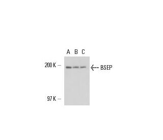 western blotting image from recommended BSEP (F-6) monoclonal antibody replacement. Image 17037