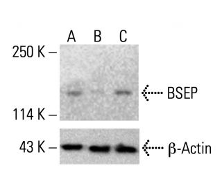 BSEP Antibody (F-6) - Western Blotting - Image 412657The Double Nickase Plasmid features a U6 promoter for sgRNA expression, a 20 nt targeting sequence, and a gRNA scaffold to guide Cas9n. It includes a CBh promoter for Cas9n (D10A) and puromycin resistance, GFP for transfection verification, and nuclear localization signals (NLS). The 2A peptide allows co-expression of Cas9n and Puro from a single promoter, enabling precise genome editing with reduced off-target effects.