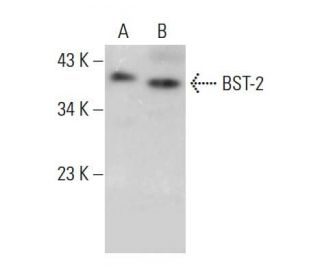 BST-2 Antibody (E-4) - Western Blotting - Image 381074Each CRISPR/Cas9 Knockout (KO) Plasmid product consists of a pool of 3 plasmids designed to ensure identification and cleavage of a specific gene for maximum knockout efficiency. Each plasmid encodes a unique 20 nt sequence derived from the GeCKO (v2) library. 